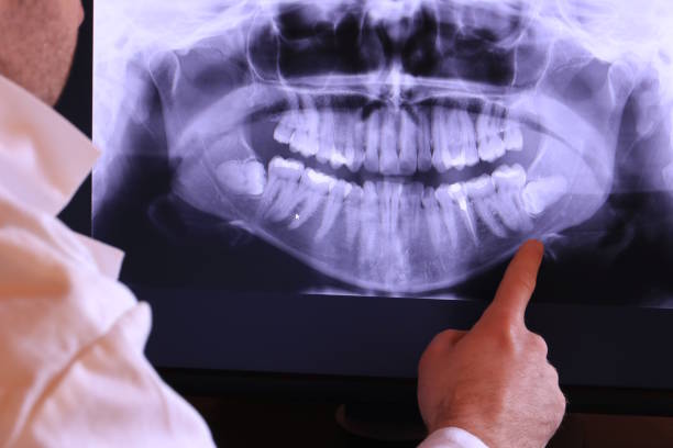 Best Emergency Dentist for Lost Fillings or Crowns in Blackhawk, SD